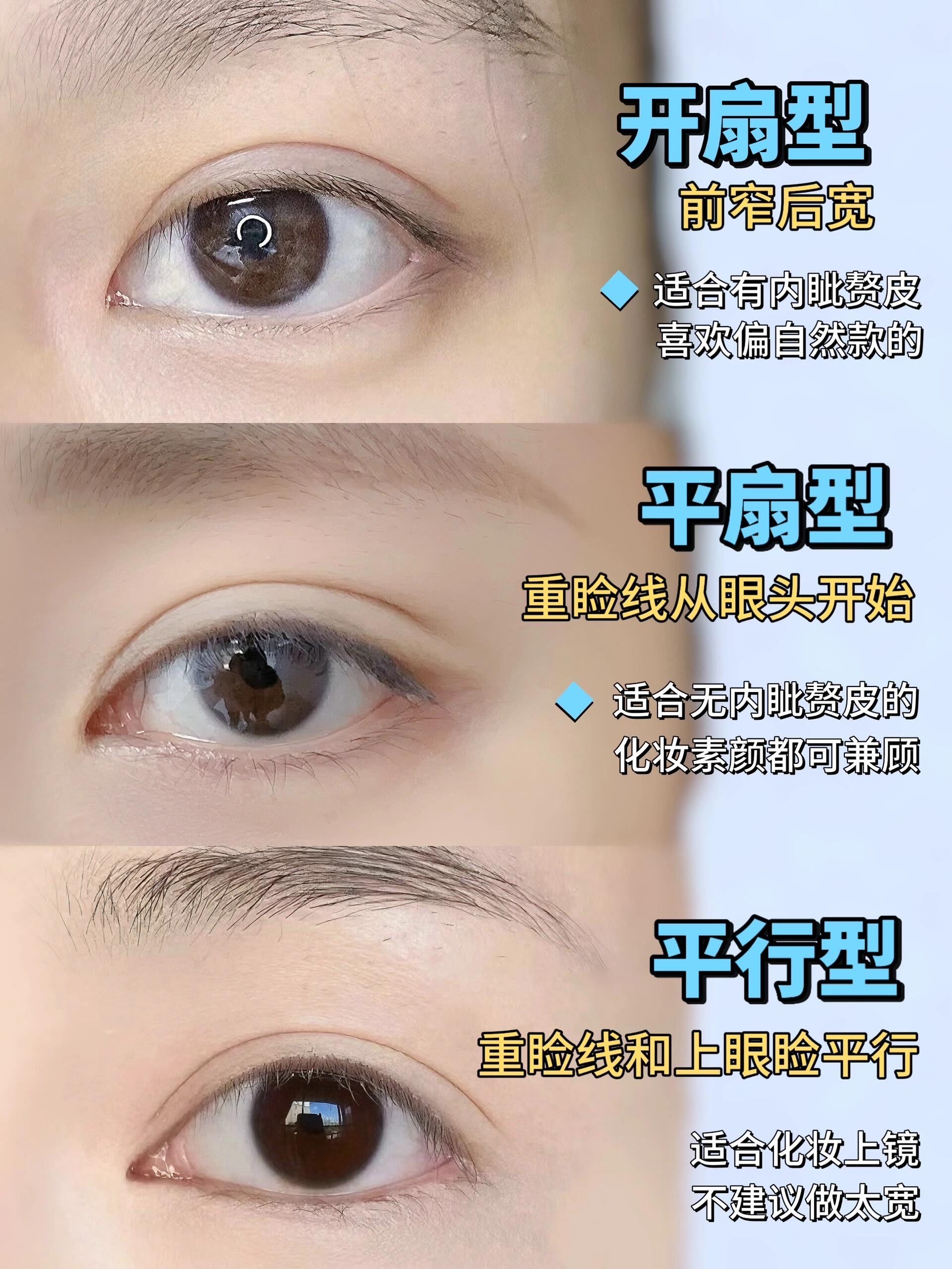 三种常见双眼皮形态~自测适合哪种?✨