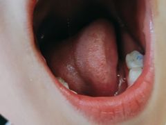 -极橙儿童齿科矫正中心(奥城店)