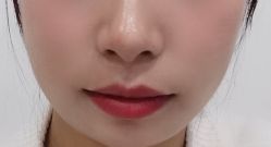 -东剑医学美容·注射美学中心