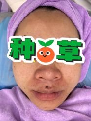 体验前-天其美科学美肤·生发健康管理