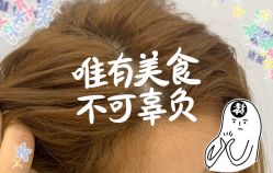 -大麦微针植发全国连锁