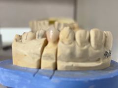 -上海仁爱医院口腔科 · 种植