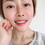 [礼花][礼花]撒花庆祝~！！小美女今天戴上牙套啦