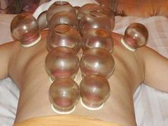 拔罐子-舒馨坊养生会所·足浴·油压·SPA(瑞景店)