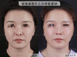 -北京米扬丽格医疗美容·联合丽格鼻整形中心