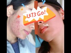 -苗方清颜痘肌研究所