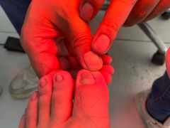 -新甲连锁灰指甲·甲沟炎·鸡眼(黑龙江路店)