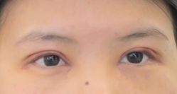 -联合丽格·张菡丽格医疗美容