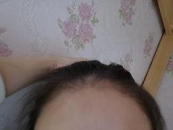 -熙朵美学植发连锁