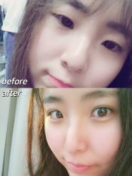 -兰州华美整形美容医院