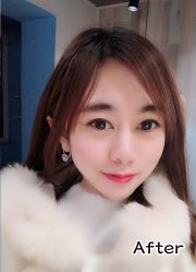 -小忠丽格医美