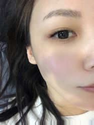 -More摩尔医美の注射线雕光电中心