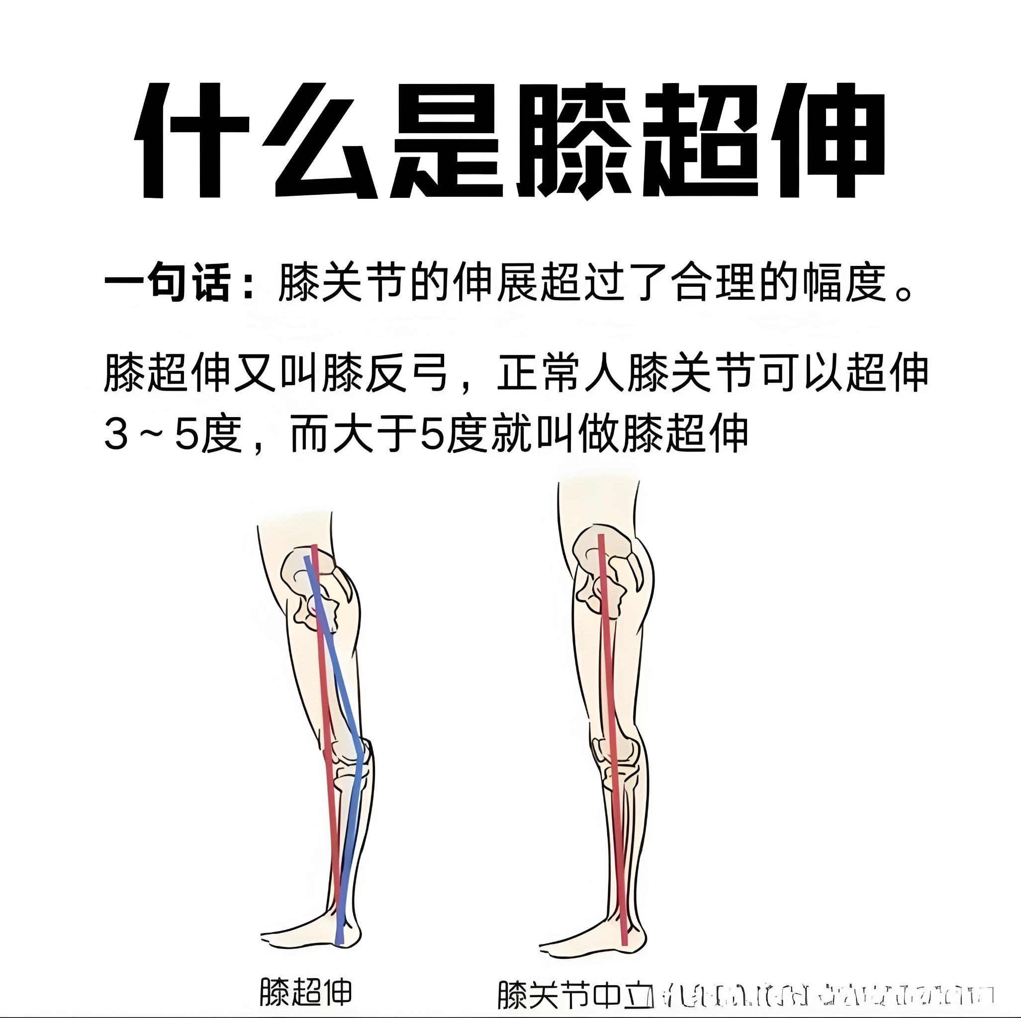 膝关节的屈伸运动图解图片