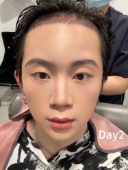 -熙朵美学植发·连锁品牌