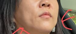 -广州美莱医疗美容医院