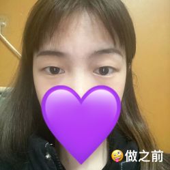 点击看大图 体验前-广州美莱医疗美容医院