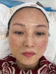 体验前-禾丽康美医疗美容医院