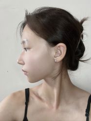 -四川米兰柏羽医学美容医院
