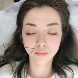 点击看大图 -西施无菌半永久纹绣眉眼影唇轻增发纹发际线