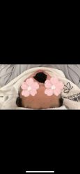 体验前-苗方清颜专业祛痘