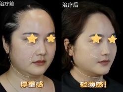 -Yestar重庆艺星医疗美容医院