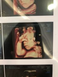 -杭州贝瑞斯美华妇儿医院·早孕·产检·儿科