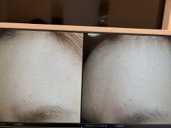 -苑苑vbeauty科技美容SPA