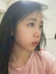 -天津健丽·去眼袋医疗美容机构