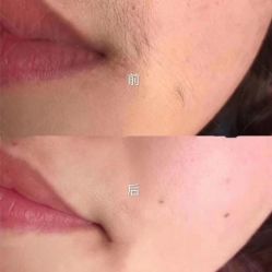 点击看大图 -skin79皮肤管理基站