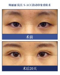 -丰联丽格医疗美容·联合丽格眼整形中心