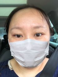 体验后-金圣医疗美容