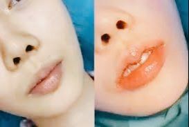 点击看大图 -SKINIST丽铂医疗美容