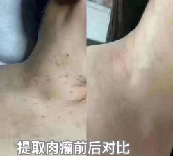 -香薇妮丝·定制减肥·身材管理