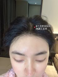 -雍禾植发全国连锁