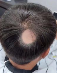 -发饰美男士增发补发假发定制店