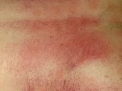 -左悦·艾灸调理·推拿按摩·精油SPA(卓悦汇店)