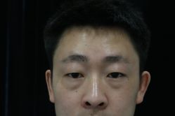 -Yestar宁波艺星整形医院