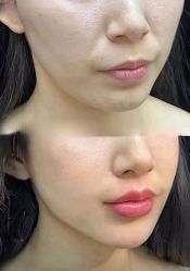 -上海伊莱美医疗美容医院