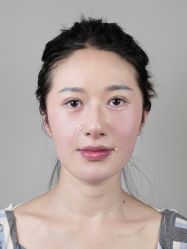 -Yestar艺星医疗美容医院