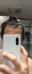 -大麦微针植发丨全国连锁