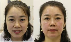 -丰联丽格医疗美容·联合丽格眼整形中心