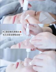 -SKIN79皮肤管理中心