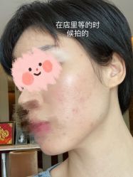 体验前-深圳广和门诊部·整形医疗美容
