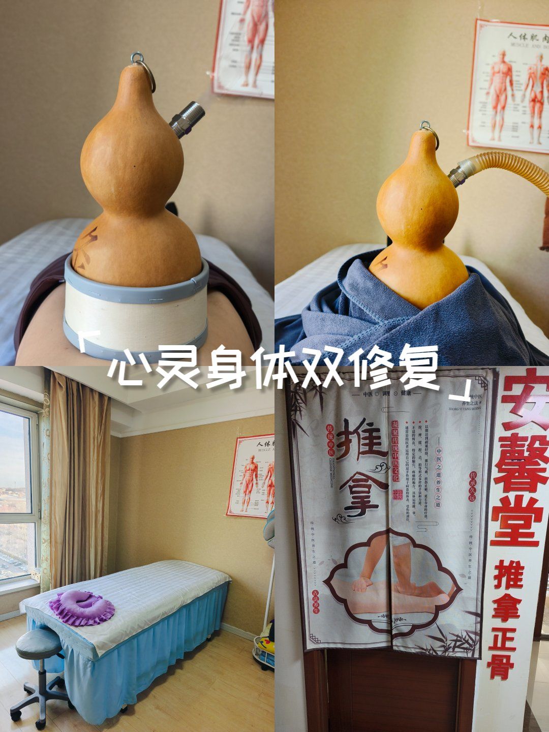 我的第一次葫芦灸体验