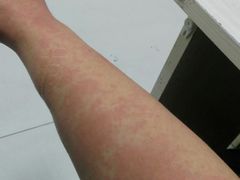 -龙达温泉生态城