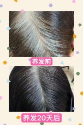 -希梵尔头皮抗衰·科技养发