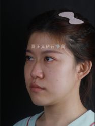 -北京米扬丽格医疗美容·联合丽格鼻整形中心