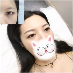 -MIVI·纹眉半永久野生眉
