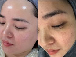 -+MS卓美丝专业祛痘·皮肤管理中心