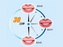 -团圆口腔·种植中心(锦江院区)